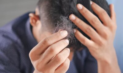 Does Betacap Cause Hair Loss